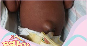 Nursing the Umbilical Cord and Circumcision Wounds